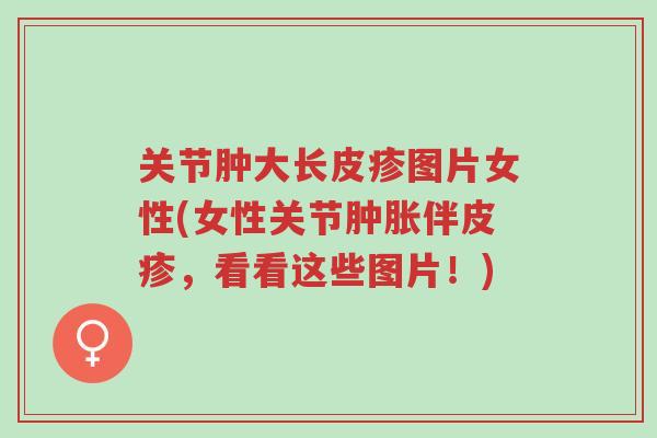 关节肿大长皮疹图片女性(女性关节肿胀伴皮疹,看看这些图片!)-第1张图片-超越 关节肿大长皮疹图片女性(女性关节肿胀伴皮疹,看看这些图片!)-第1张图片-超越