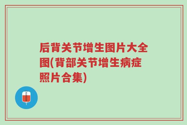 后背关节增生图片大全图(背部关节增生病症照片合集)-第1张图片-超越