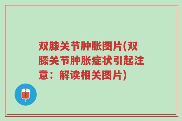 双膝关节肿胀图片(双膝关节肿胀症状引起注意:解读相关图片)-第1张图片-超越 双膝关节肿胀图片(双膝关节肿胀症状引起注意:解读相关图片)-第1张图片-超越