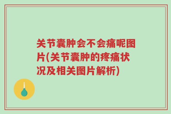关节囊肿会不会痛呢图片(关节囊肿的疼痛状况及相关图片解析)-第1张图片-超越 关节囊肿会不会痛呢图片(关节囊肿的疼痛状况及相关图片解析)-第1张图片-超越
