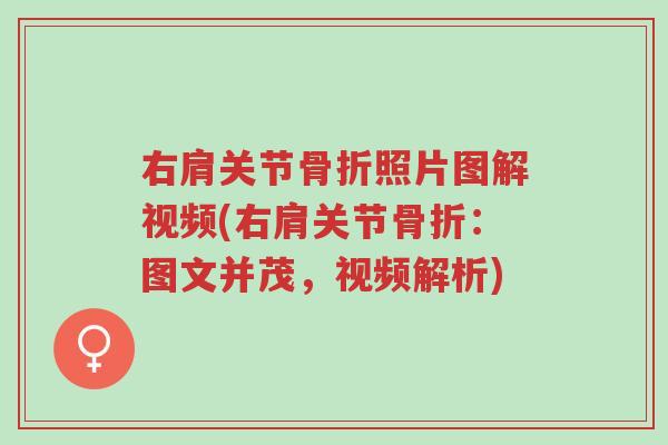 右肩关节骨折照片图解视频(右肩关节骨折:图文并茂,视频解析)-第1张图片-超越 右肩关节骨折照片图解视频(右肩关节骨折:图文并茂,视频解析)-第1张图片-超越