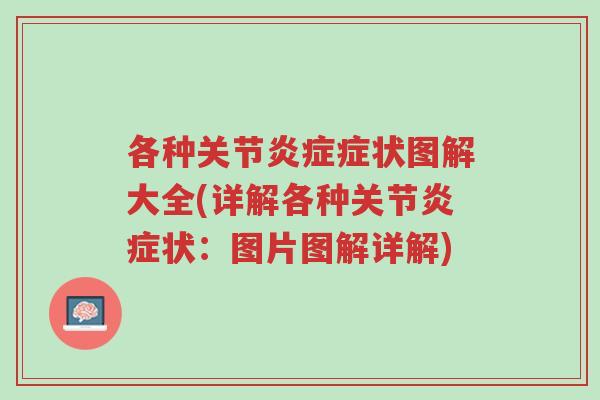 各种关节炎症症状图解大全(详解各种关节炎症状:图片图解详解)-第1张图片-超越 各种关节炎症症状图解大全(详解各种关节炎症状:图片图解详解)-第1张图片-超越