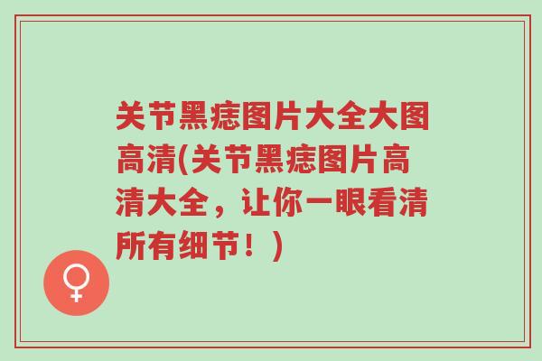 关节黑痣图片大全大图高清(关节黑痣图片高清大全,让你一眼看清所有细节!)-第1张图片-超越 关节黑痣图片大全大图高清(关节黑痣图片高清大全,让你一眼看清所有细节!)-第1张图片-超越