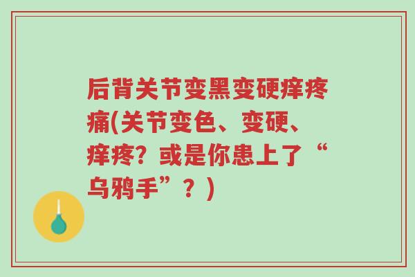 后背关节变黑变硬痒疼痛(关节变色、变硬、痒疼?或是你患上了“乌鸦手”?)-第1张图片-超越 后背关节变黑变硬痒疼痛(关节变色、变硬、痒疼?或是你患上了“乌鸦手”?)-第1张图片-超越