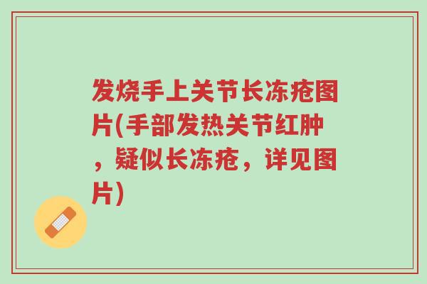 发烧手上关节长冻疮图片(手部发热关节红肿,疑似长冻疮,详见图片)-第1张图片-超越 发烧手上关节长冻疮图片(手部发热关节红肿,疑似长冻疮,详见图片)-第1张图片-超越
