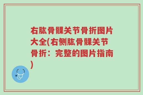 右肱骨髁关节骨折图片大全(右侧肱骨髁关节骨折：完整的图片指南)-第1张图片-超越