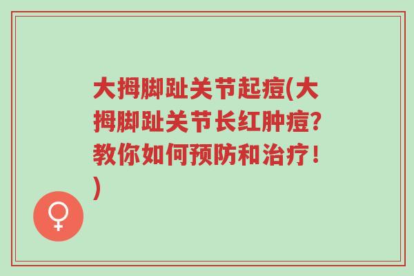 大拇脚趾关节起痘(大拇脚趾关节长红肿痘?教你如何预防和治疗!)-第1张图片-超越 大拇脚趾关节起痘(大拇脚趾关节长红肿痘?教你如何预防和治疗!)-第1张图片-超越