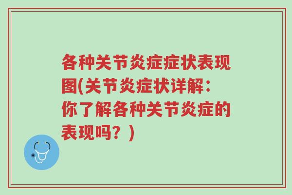 各种关节炎症症状表现图(关节炎症状详解:你了解各种关节炎症的表现吗?)-第1张图片-超越 各种关节炎症症状表现图(关节炎症状详解:你了解各种关节炎症的表现吗?)-第1张图片-超越