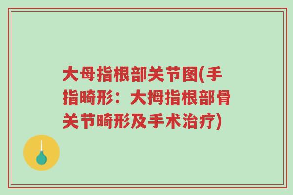 大母指根部关节图(手指畸形:大拇指根部骨关节畸形及手术治疗)-第1张图片-超越 大母指根部关节图(手指畸形:大拇指根部骨关节畸形及手术治疗)-第1张图片-超越