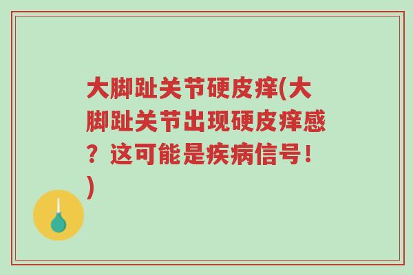 大脚趾关节硬皮痒(大脚趾关节出现硬皮痒感?这可能是疾病信号!)-第1张图片-超越 大脚趾关节硬皮痒(大脚趾关节出现硬皮痒感?这可能是疾病信号!)-第1张图片-超越