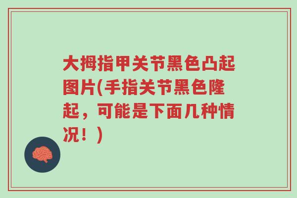 大拇指甲关节黑色凸起图片(手指关节黑色隆起,可能是下面几种情况!)-第1张图片-超越 大拇指甲关节黑色凸起图片(手指关节黑色隆起,可能是下面几种情况!)-第1张图片-超越