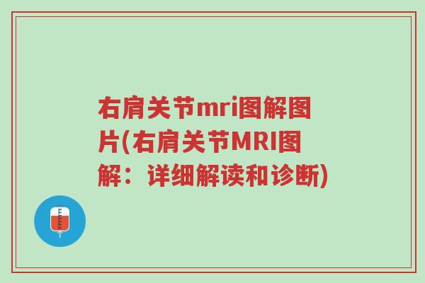 右肩关节mri图解图片(右肩关节MRI图解:详细解读和诊断)-第1张图片-超越 右肩关节mri图解图片(右肩关节MRI图解:详细解读和诊断)-第1张图片-超越