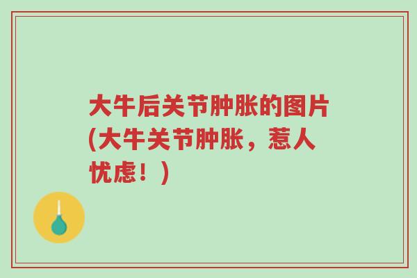 大牛后关节肿胀的图片(大牛关节肿胀,惹人忧虑!)-第1张图片-超越 大牛后关节肿胀的图片(大牛关节肿胀,惹人忧虑!)-第1张图片-超越