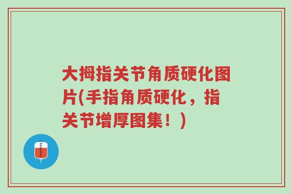 大拇指关节角质硬化图片(手指角质硬化,指关节增厚图集!)-第1张图片-超越 大拇指关节角质硬化图片(手指角质硬化,指关节增厚图集!)-第1张图片-超越