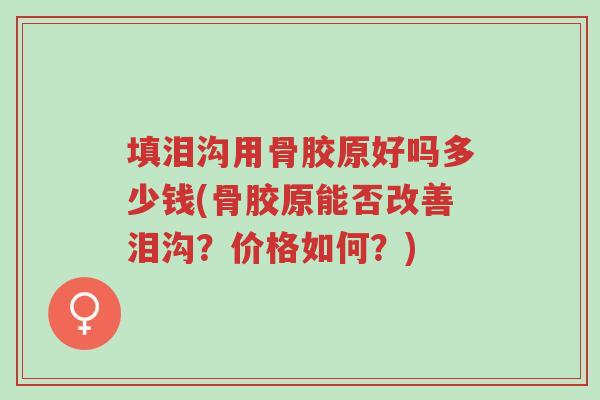 填泪沟用骨胶原好吗多少钱(骨胶原能否改善泪沟?价格如何?)-第1张图片-超越 填泪沟用骨胶原好吗多少钱(骨胶原能否改善泪沟?价格如何?)-第1张图片-超越