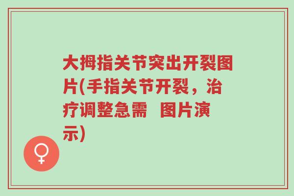 大拇指关节突出开裂图片(手指关节开裂,治疗调整急需 图片演示)-第1张图片-超越 大拇指关节突出开裂图片(手指关节开裂,治疗调整急需 图片演示)-第1张图片-超越