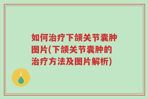 如何治疗下颌关节囊肿图片(下颌关节囊肿的治疗方法及图片解析)-第1张图片-超越