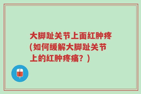 大脚趾关节上面红肿疼(如何缓解大脚趾关节上的红肿疼痛？)-第1张图片-超越
