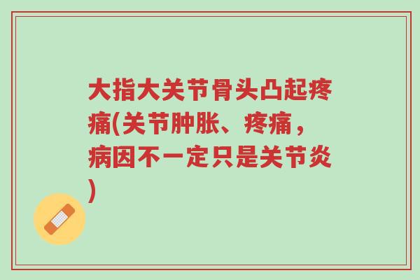 大指大关节骨头凸起疼痛(关节肿胀、疼痛,病因不一定只是关节炎)-第1张图片-超越 大指大关节骨头凸起疼痛(关节肿胀、疼痛,病因不一定只是关节炎)-第1张图片-超越