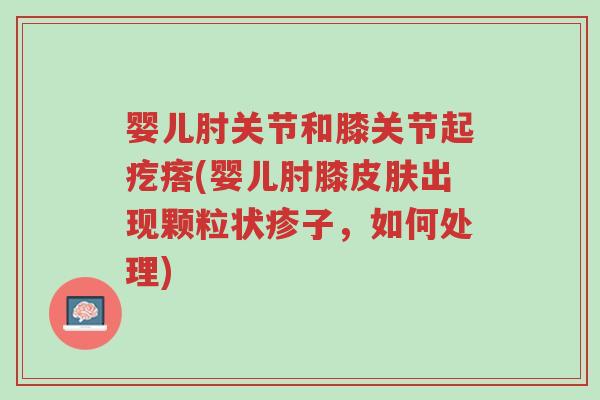 婴儿肘关节和膝关节起疙瘩(婴儿肘膝皮肤出现颗粒状疹子,如何处理)-第1张图片-超越 婴儿肘关节和膝关节起疙瘩(婴儿肘膝皮肤出现颗粒状疹子,如何处理)-第1张图片-超越