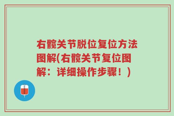 右髋关节脱位复位方法图解(右髋关节复位图解:详细操作步骤!)-第1张图片-超越 右髋关节脱位复位方法图解(右髋关节复位图解:详细操作步骤!)-第1张图片-超越