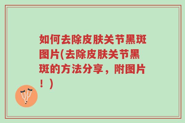 如何去除皮肤关节黑斑图片(去除皮肤关节黑斑的方法分享,附图片!)-第1张图片-超越 如何去除皮肤关节黑斑图片(去除皮肤关节黑斑的方法分享,附图片!)-第1张图片-超越