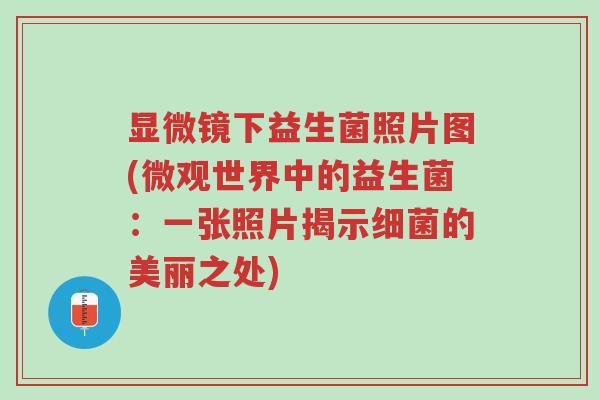 显微镜下益生菌照片图(微观世界中的益生菌:一张照片揭示细菌的美丽之处)-第1张图片-超越 显微镜下益生菌照片图(微观世界中的益生菌:一张照片揭示细菌的美丽之处)-第1张图片-超越