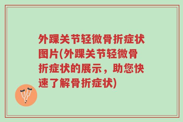 外踝关节轻微骨折症状图片(外踝关节轻微骨折症状的展示,助您快速了解骨折症状)-第1张图片-超越 外踝关节轻微骨折症状图片(外踝关节轻微骨折症状的展示,助您快速了解骨折症状)-第1张图片-超越