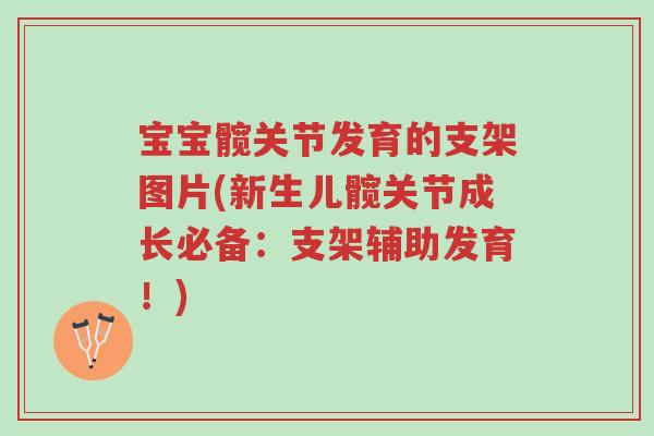 宝宝髋关节发育的支架图片(新生儿髋关节成长必备:支架辅助发育!)-第1张图片-超越 宝宝髋关节发育的支架图片(新生儿髋关节成长必备:支架辅助发育!)-第1张图片-超越