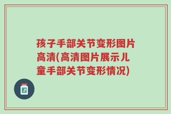 孩子手部关节变形图片高清(高清图片展示儿童手部关节变形情况)-第1张图片-超越 孩子手部关节变形图片高清(高清图片展示儿童手部关节变形情况)-第1张图片-超越