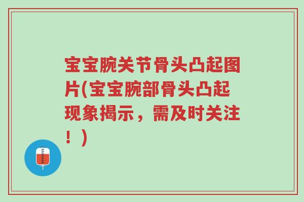 宝宝腕关节骨头凸起图片(宝宝腕部骨头凸起现象揭示,需及时关注!)-第1张图片-超越 宝宝腕关节骨头凸起图片(宝宝腕部骨头凸起现象揭示,需及时关注!)-第1张图片-超越