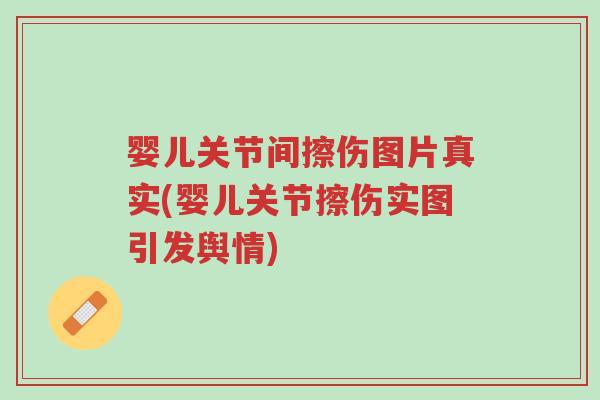 婴儿关节间擦伤图片真实(婴儿关节擦伤实图引发舆情)-第1张图片-超越 婴儿关节间擦伤图片真实(婴儿关节擦伤实图引发舆情)-第1张图片-超越