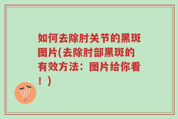 如何去除肘关节的黑斑图片(去除肘部黑斑的有效方法:图片给你看!)-第1张图片-超越 如何去除肘关节的黑斑图片(去除肘部黑斑的有效方法:图片给你看!)-第1张图片-超越