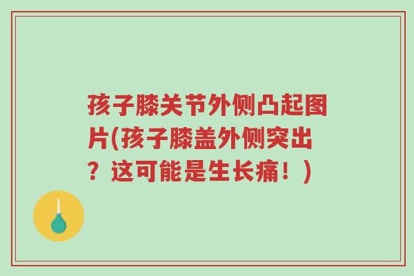 孩子膝关节外侧凸起图片(孩子膝盖外侧突出?这可能是生长痛!)-第1张图片-超越 孩子膝关节外侧凸起图片(孩子膝盖外侧突出?这可能是生长痛!)-第1张图片-超越