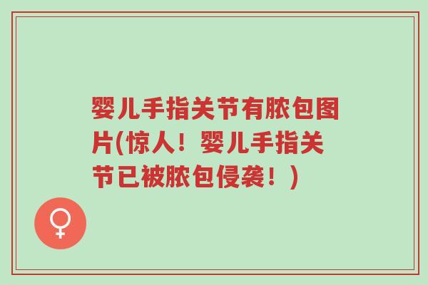 婴儿手指关节有脓包图片(惊人!婴儿手指关节已被脓包侵袭!)-第1张图片-超越 婴儿手指关节有脓包图片(惊人!婴儿手指关节已被脓包侵袭!)-第1张图片-超越