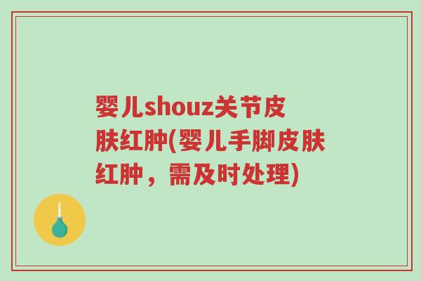 婴儿shouz关节皮肤红肿(婴儿手脚皮肤红肿,需及时处理)-第1张图片-超越 婴儿shouz关节皮肤红肿(婴儿手脚皮肤红肿,需及时处理)-第1张图片-超越