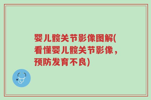 婴儿髋关节影像图解(看懂婴儿髋关节影像,预防发育不良)-第1张图片-超越 婴儿髋关节影像图解(看懂婴儿髋关节影像,预防发育不良)-第1张图片-超越