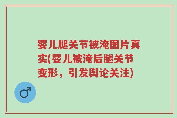 婴儿腿关节被淹图片真实(婴儿被淹后腿关节变形,引发舆论关注)-第1张图片-超越 婴儿腿关节被淹图片真实(婴儿被淹后腿关节变形,引发舆论关注)-第1张图片-超越