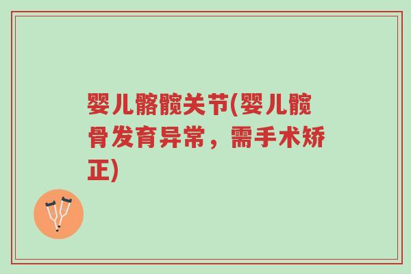 婴儿髂髋关节(婴儿髋骨发育异常,需手术矫正)-第1张图片-超越 婴儿髂髋关节(婴儿髋骨发育异常,需手术矫正)-第1张图片-超越