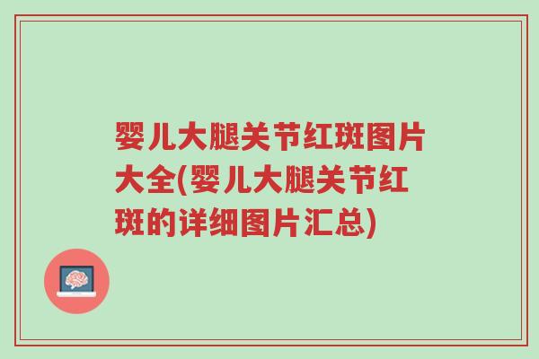 婴儿大腿关节红斑图片大全(婴儿大腿关节红斑的详细图片汇总)-第1张图片-超越 婴儿大腿关节红斑图片大全(婴儿大腿关节红斑的详细图片汇总)-第1张图片-超越