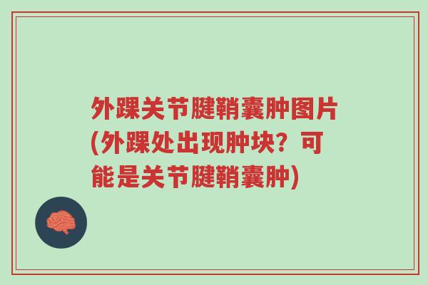 外踝关节腱鞘囊肿图片(外踝处出现肿块?可能是关节腱鞘囊肿)-第1张图片-超越 外踝关节腱鞘囊肿图片(外踝处出现肿块?可能是关节腱鞘囊肿)-第1张图片-超越