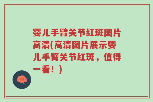 婴儿手臂关节红斑图片高清(高清图片展示婴儿手臂关节红斑,值得一看!)-第1张图片-超越 婴儿手臂关节红斑图片高清(高清图片展示婴儿手臂关节红斑,值得一看!)-第1张图片-超越