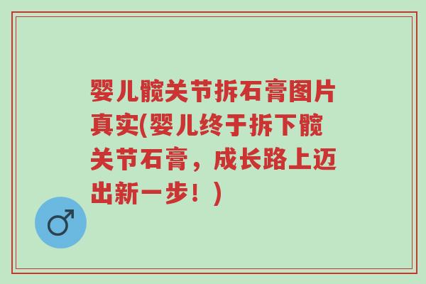 婴儿髋关节拆石膏图片真实(婴儿终于拆下髋关节石膏,成长路上迈出新一步!)-第1张图片-超越 婴儿髋关节拆石膏图片真实(婴儿终于拆下髋关节石膏,成长路上迈出新一步!)-第1张图片-超越