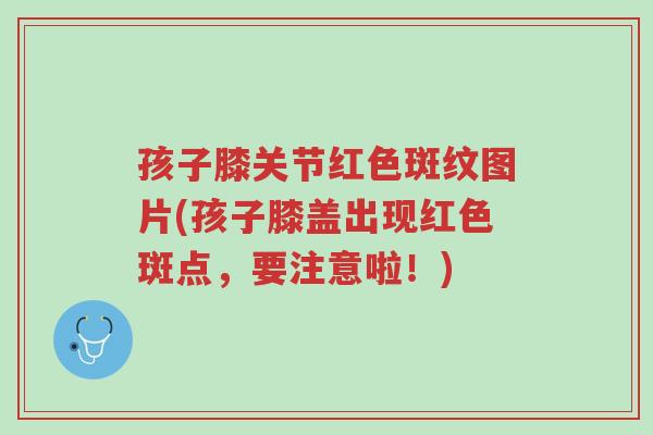孩子膝关节红色斑纹图片(孩子膝盖出现红色斑点,要注意啦!)-第1张图片-超越 孩子膝关节红色斑纹图片(孩子膝盖出现红色斑点,要注意啦!)-第1张图片-超越