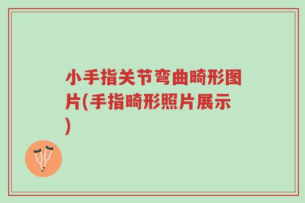 小手指关节弯曲畸形图片(手指畸形照片展示)-第1张图片-超越 小手指关节弯曲畸形图片(手指畸形照片展示)-第1张图片-超越
