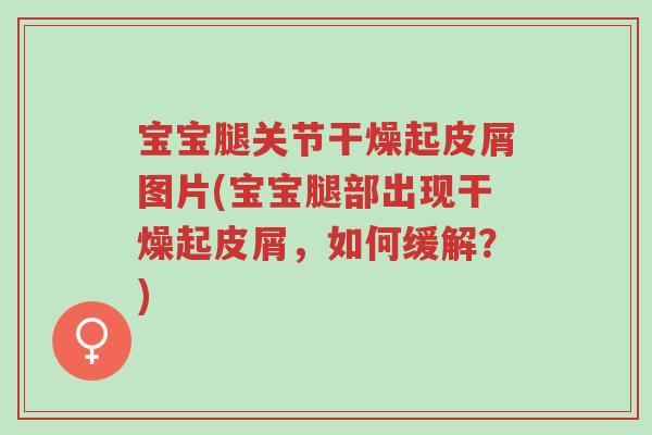 宝宝腿关节干燥起皮屑图片(宝宝腿部出现干燥起皮屑,如何缓解?)-第1张图片-超越 宝宝腿关节干燥起皮屑图片(宝宝腿部出现干燥起皮屑,如何缓解?)-第1张图片-超越