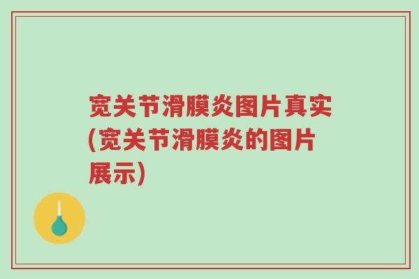 宽关节滑膜炎图片真实(宽关节滑膜炎的图片展示)-第1张图片-超越 宽关节滑膜炎图片真实(宽关节滑膜炎的图片展示)-第1张图片-超越