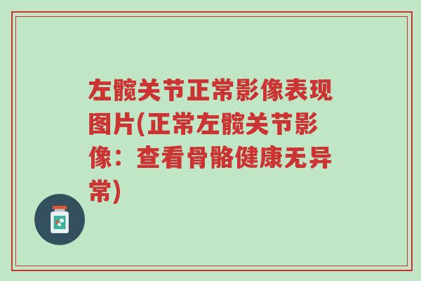 左髋关节正常影像表现图片(正常左髋关节影像:查看骨骼健康无异常)-第1张图片-超越 左髋关节正常影像表现图片(正常左髋关节影像:查看骨骼健康无异常)-第1张图片-超越