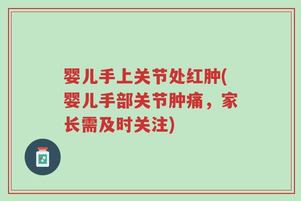 婴儿手上关节处红肿(婴儿手部关节肿痛,家长需及时关注)-第1张图片-超越 婴儿手上关节处红肿(婴儿手部关节肿痛,家长需及时关注)-第1张图片-超越