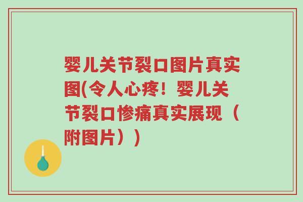 婴儿关节裂口图片真实图(令人心疼！婴儿关节裂口惨痛真实展现（附图片）)-第1张图片-超越